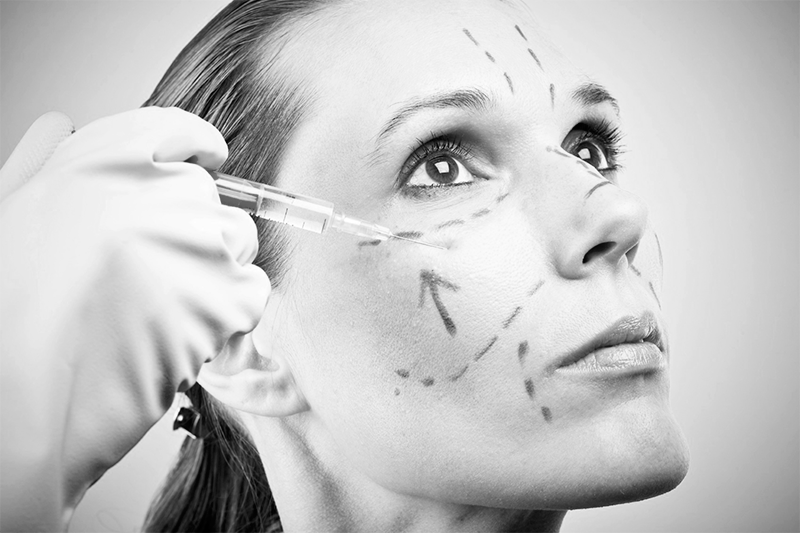 Implantes y lipoescultura facial